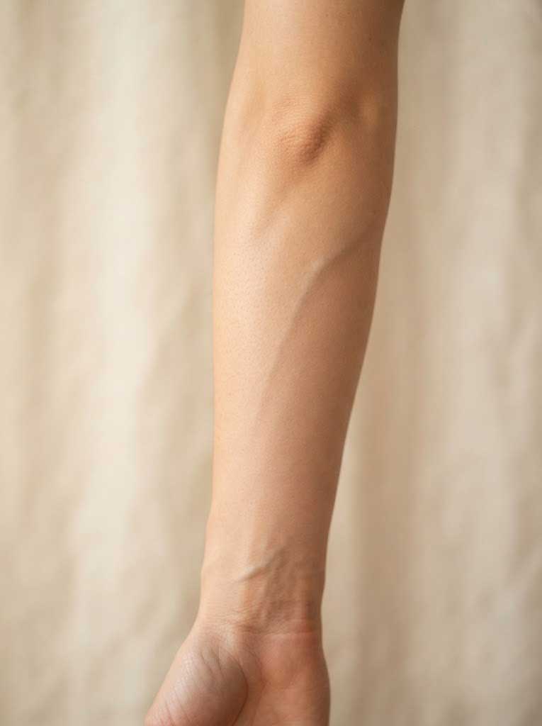 Forearm